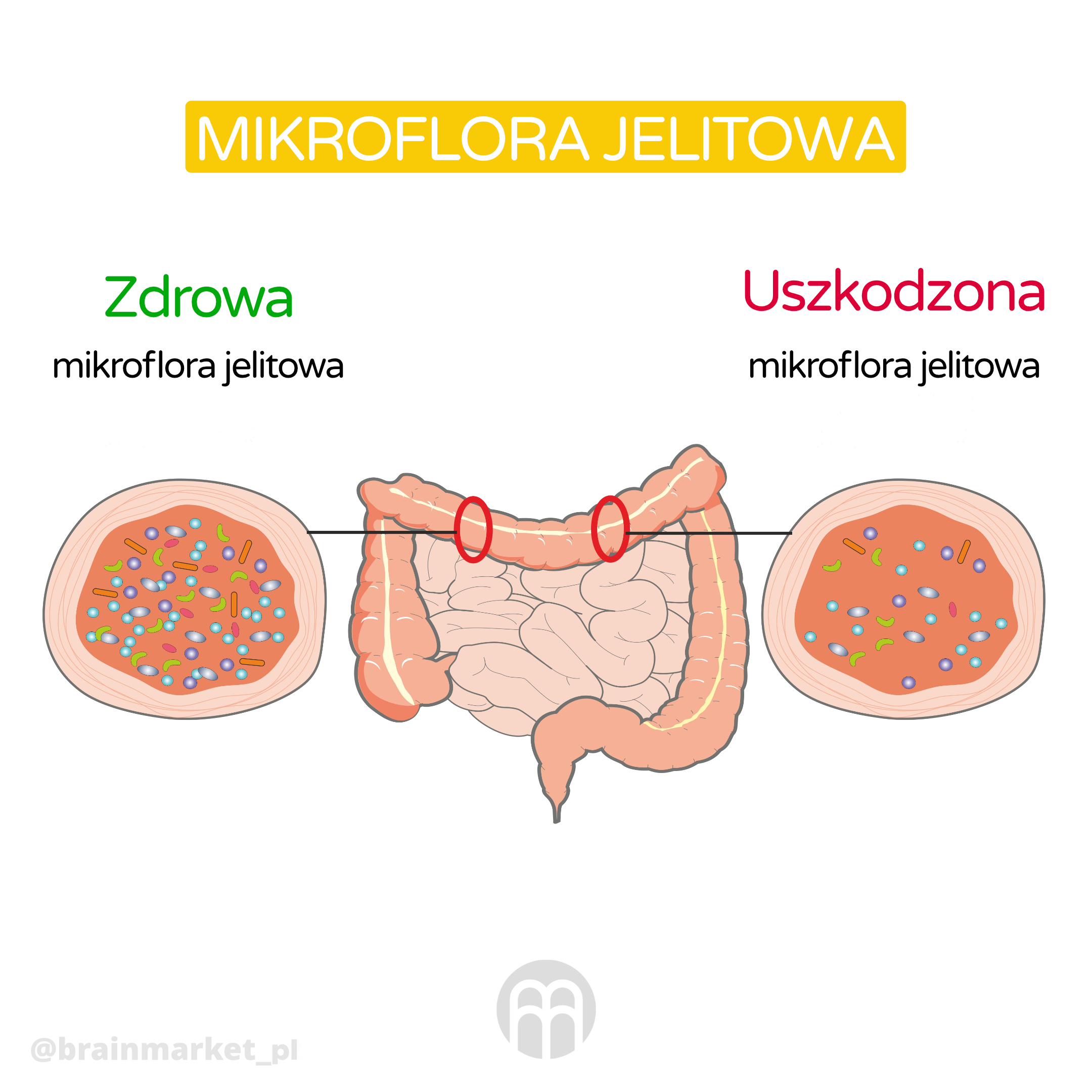 strevni mikroflora_infografika_cz